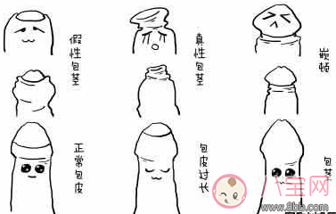 包皮過長有哪些原因及癥狀 包皮過長應該怎么辦