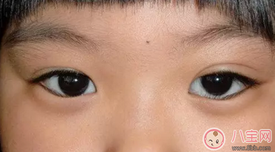 新生兒寶寶眨眼反射 寶寶愛(ài)眨眼是病嗎