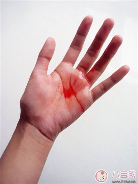 上環(huán)出血幾天算正常 上環(huán)后出血怎么辦 上環(huán)出血幾天算正常 上環(huán)后出血怎么辦