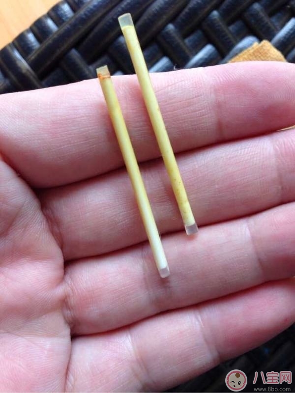 埋線避孕法能百分百避孕嗎 埋線避孕法有哪些副作用