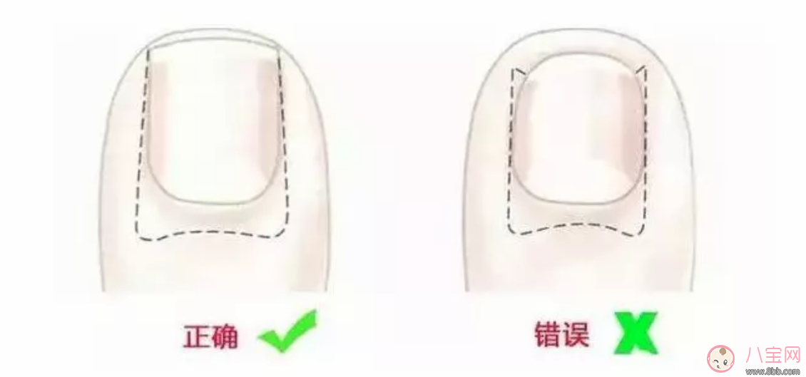 在什么時間給寶寶剪指甲最好 寶寶睡覺剪指甲好還是醒著的時候 在什么時間給寶寶剪指甲最好 寶寶睡覺剪指甲好還是醒著的時候