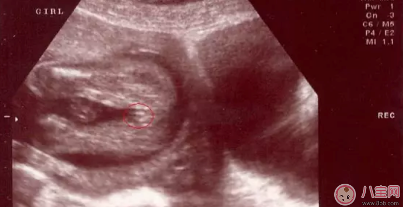B超怎么看男女 如何通過(guò)四維彩超圖看生男生女