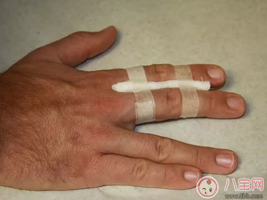 孩子手指伸不直是什么情況，為什么孩子的手指伸不直