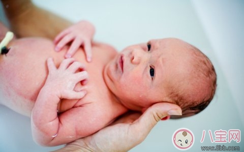 小兒疝氣怎么治療 小兒疝氣有什么癥狀 小兒疝氣怎么治療 小兒疝氣有什么癥狀