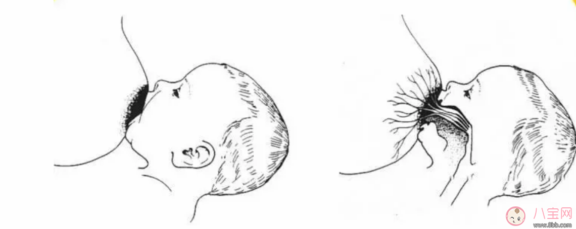 母乳喂養(yǎng)乳頭變白發(fā)硬怎么回事 乳頭變白且硬怎么辦 母乳喂養(yǎng)乳頭變白發(fā)硬怎么回事 乳頭變白且硬怎么辦