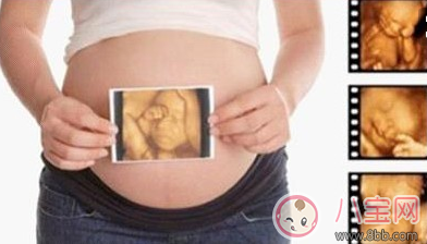 做四維彩超需要空腹嗎 做四維彩超的最佳時間