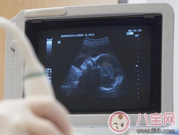 懷孕最早什么時(shí)候能測(cè)出結(jié)果 懷孕什么時(shí)候有癥狀表現(xiàn) 懷孕最早什么時(shí)候能測(cè)出結(jié)果 懷孕什么時(shí)候有癥狀表現(xiàn)