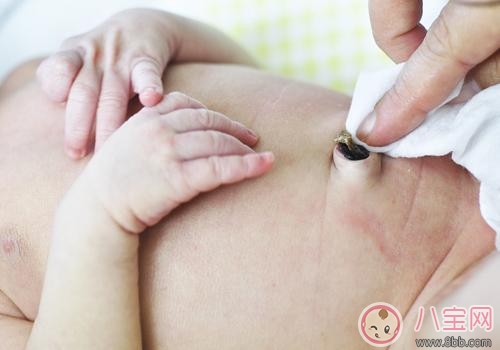 新生兒臍帶脫落后怎么護理 新生兒臍帶有點化膿怎么辦