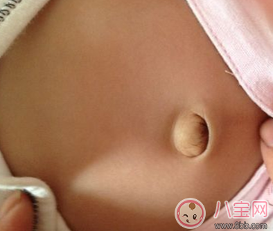 新生兒臍帶脫落后怎么護理 新生兒臍帶有點化膿怎么辦