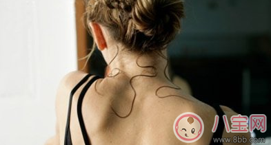 多汗癥可以吃哪些食物 多汗癥的食療方法