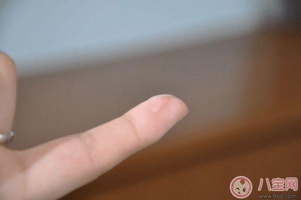 避孕套正確的使用應該戴 避孕套的使用錯誤演示