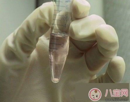 怎樣提高人工授精成功率 人工授精要花多少錢(qián)