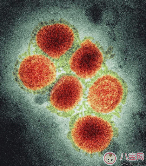 甲型H1N1怎么預防 甲型H1N1可以打疫苗預防嗎 甲型H1N1怎么預防 甲型H1N1可以打疫苗預防嗎