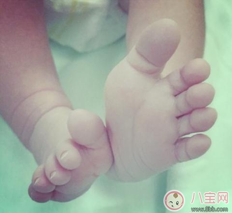 剖腹產會不會造成孩子肥胖 分娩方法孕婦要怎樣選擇