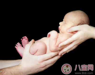 新生兒出現水腫怎么回事 新生兒正常與病態現象的區別