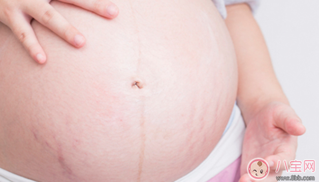 懷孕為什么要少去地下停車場 胎寶寶不喜歡哪些地方