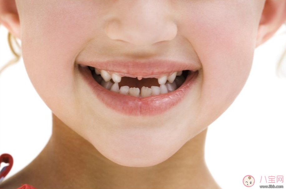 孩子換牙說話結巴怎么辦 孩子換牙齒的時候不自信怎么安撫 孩子換牙說話結巴怎么辦 孩子換牙齒的時候不自信怎么安撫