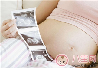 做四維彩超能拍到寶寶正臉嗎 照四維彩超的最佳時(shí)間是什么時(shí)候