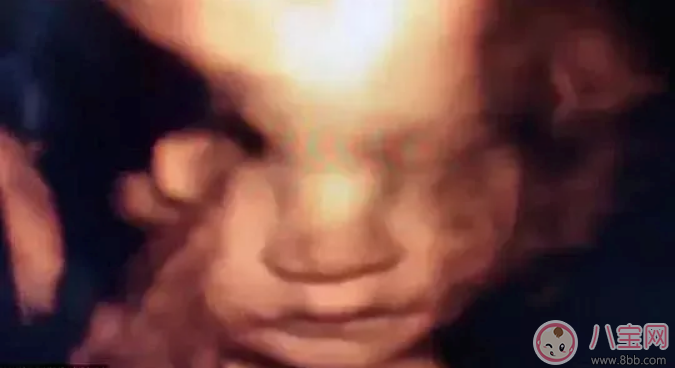 做四維彩超能拍到寶寶正臉嗎 照四維彩超的最佳時(shí)間是什么時(shí)候