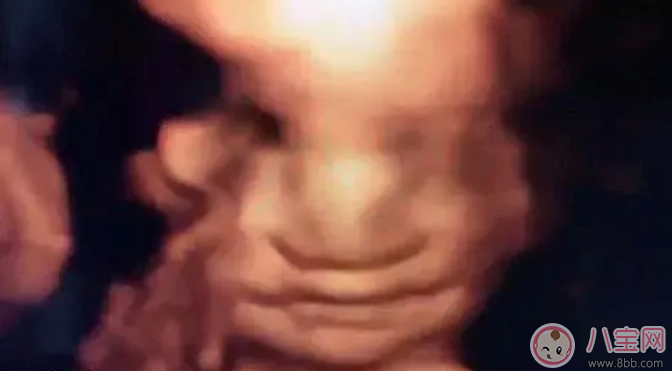 做四維彩超能拍到寶寶正臉嗎 照四維彩超的最佳時(shí)間是什么時(shí)候