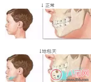 預(yù)防孩子齲齒有什么方法 怎么正確的預(yù)防孩子齲齒