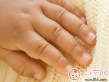 寶寶手指長倒刺是缺鋅嗎 寶寶長倒刺是缺少什么營養呢 寶寶手指長倒刺是缺鋅嗎 寶寶長倒刺是缺少什么營養呢