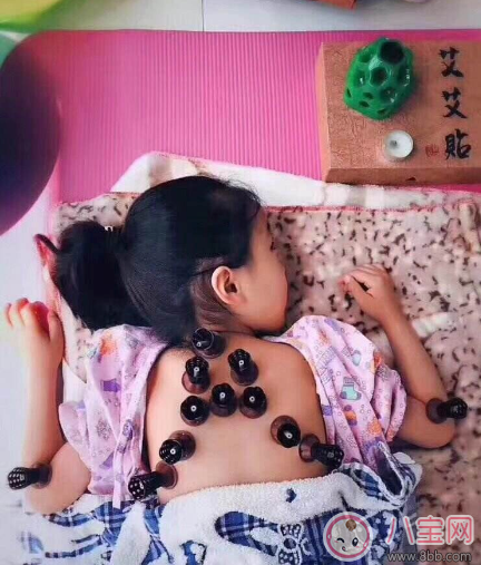 孩子可以用艾灸嗎 小孩艾灸需要多長時間