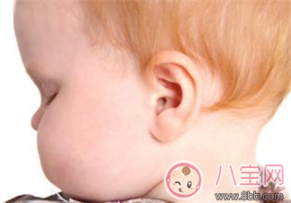 孩子老喊耳朵疼是中耳炎嗎 為什么孩子容易感染中耳炎 孩子老喊耳朵疼是中耳炎嗎 為什么孩子容易感染中耳炎