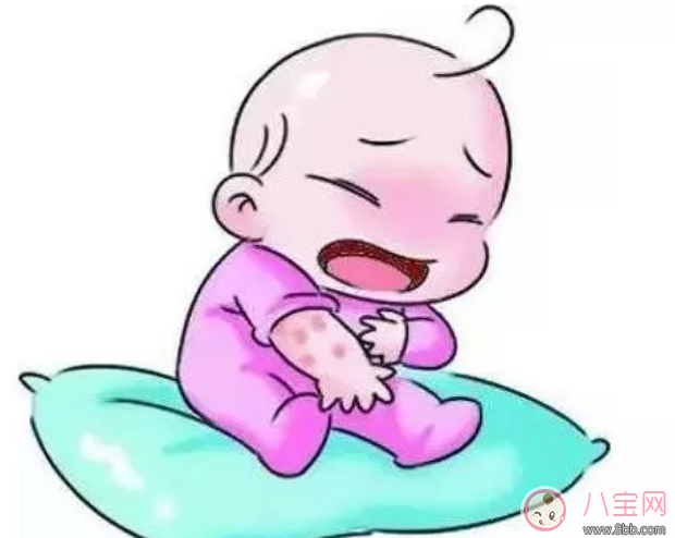 春天寶寶過敏性皮炎怎么辦 寶寶春季過敏性皮炎預防方法 春天寶寶過敏性皮炎怎么辦 寶寶春季過敏性皮炎預防方法