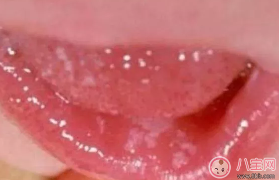 寶寶長鵝口瘡會影響吃奶嗎 新生兒長鵝口瘡用什么藥 寶寶長鵝口瘡會影響吃奶嗎 新生兒長鵝口瘡用什么藥