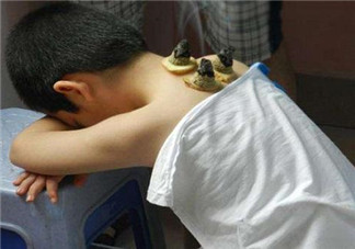 孩子發燒可以艾灸嗎 小孩發燒艾灸好不好