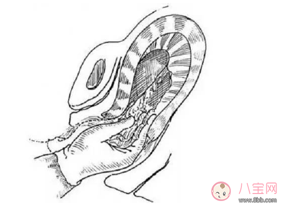 手剝胎盤沒有干凈癥狀是什么 手剝胎盤沒有干凈會(huì)有哪些影響