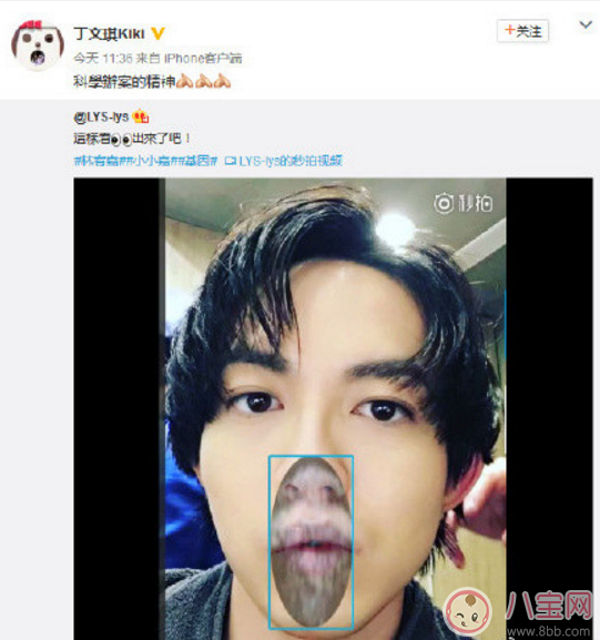 丁文琪B超照寶寶嘴唇像林宥嘉 B超寶寶長(zhǎng)相和生下來(lái)有區(qū)別嗎