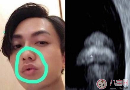 丁文琪B超照寶寶嘴唇像林宥嘉 B超寶寶長(zhǎng)相和生下來(lái)有區(qū)別嗎