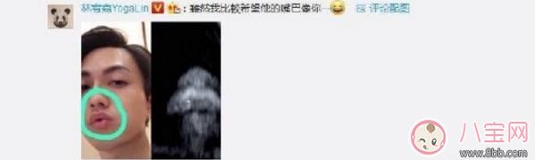 丁文琪B超照寶寶嘴唇像林宥嘉 B超寶寶長(zhǎng)相和生下來(lái)有區(qū)別嗎