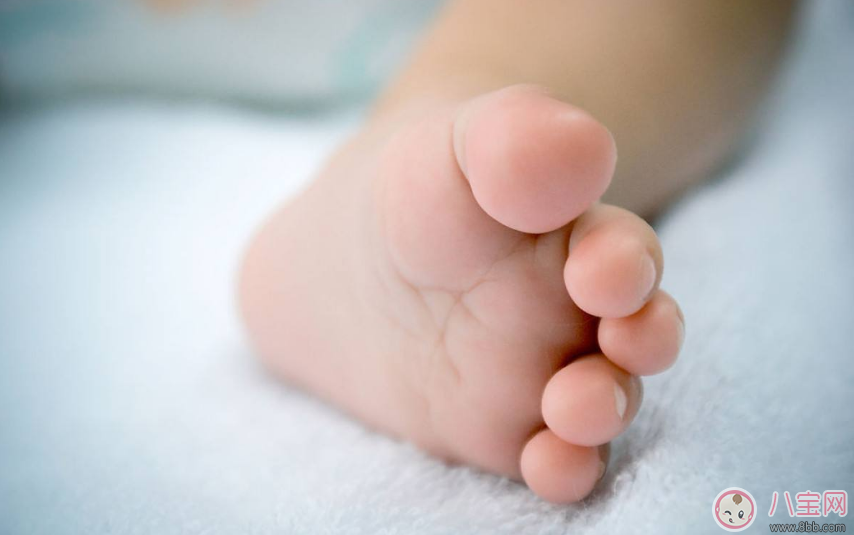 怎么判斷孩子手足口病 孩子手足口病預防方法