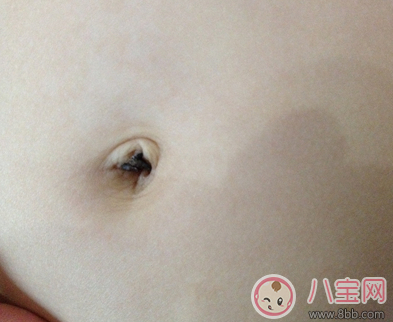 寶寶肚臍臟了怎么清洗 寶寶肚臍臟了能扣嗎