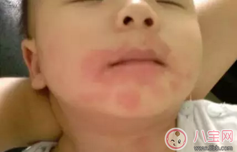 孩子在春天容易過敏怎么辦 為什么孩子總是在春天過敏