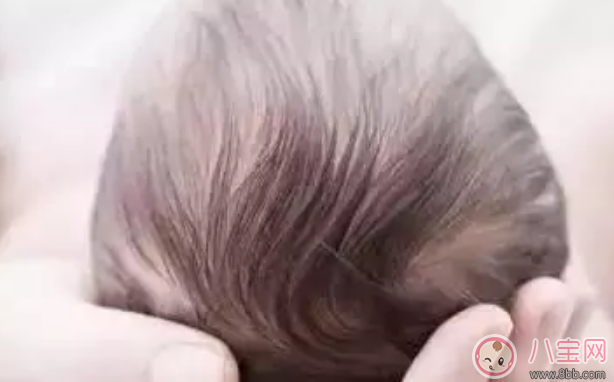 囟門閉合早晚和寶寶智力有關系嗎 寶寶囟門和智商有關系嗎