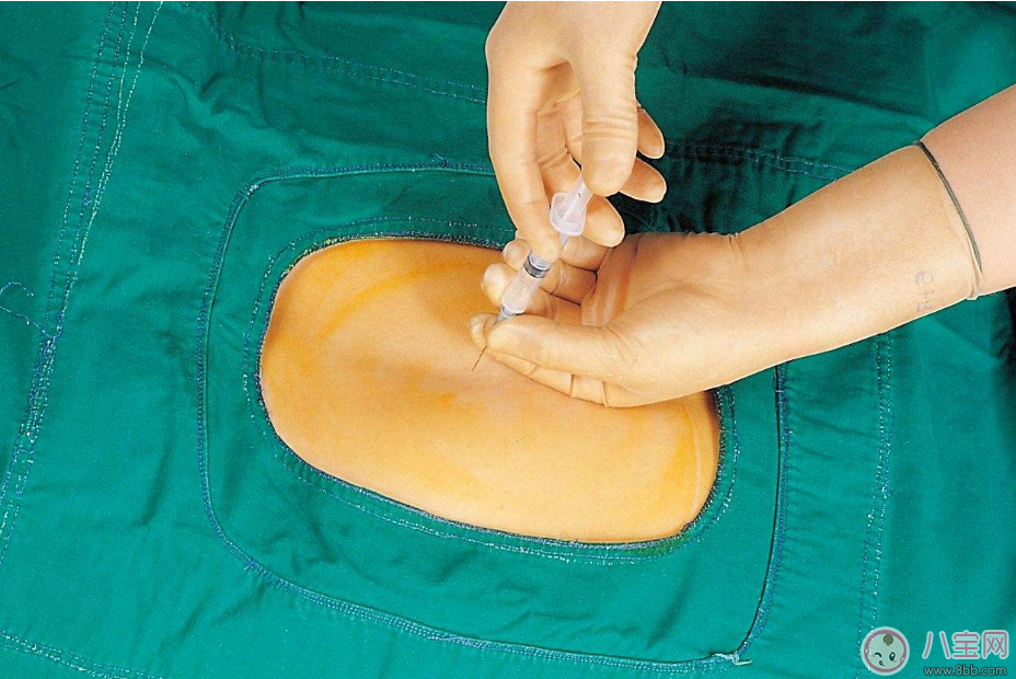 無痛分娩會對孩子產生什么樣的影響 無痛分娩好不好