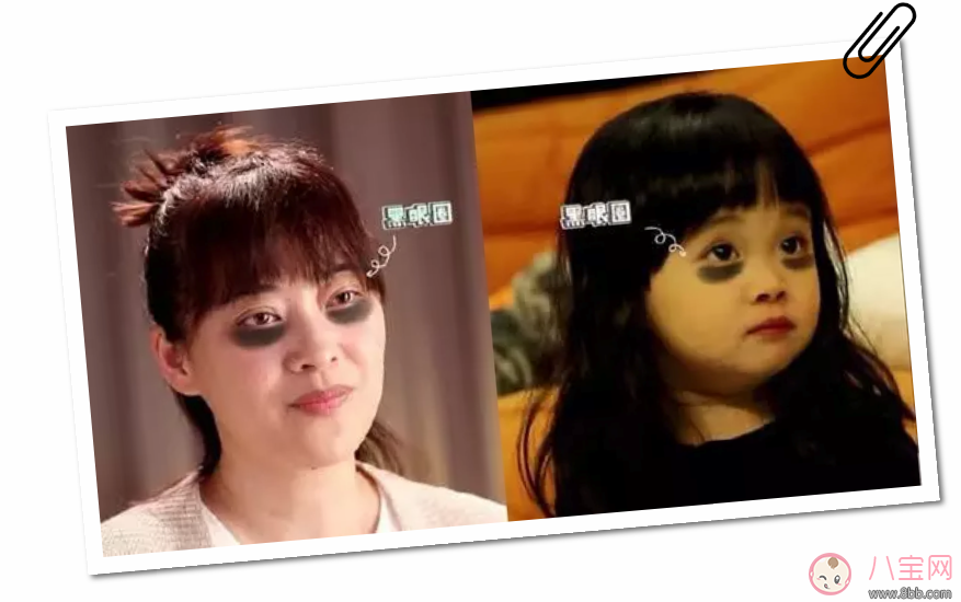 幼兒有黑眼圈怎么回事 小孩有黑眼圈是睡眠不足嗎