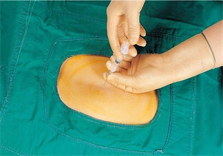 無痛分娩會對孩子產生什么樣的影響 無痛分娩好不好