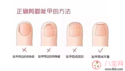 孩子春季容易起水痘怎么辦 孩子春季水痘怎么治