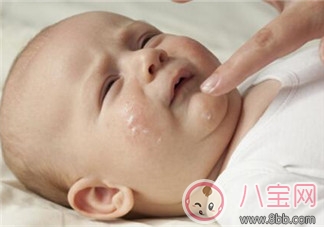 小孩濕疹反復怎么辦 濕疹為什么會反復發作