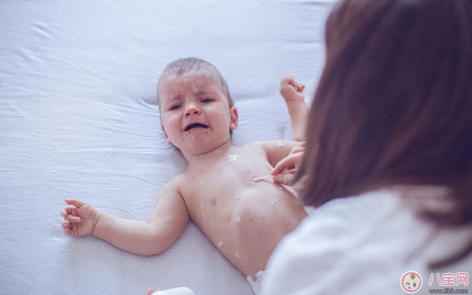 春季孩子過敏有哪些癥狀 孩子過敏預防方法