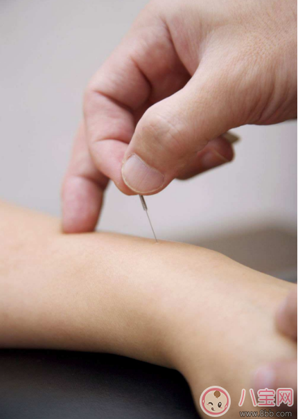 產后可以穴位埋線減肥嗎 穴位埋線減肥的原理是什么 產后可以穴位埋線減肥嗎 穴位埋線減肥的原理是什么