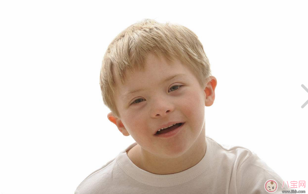 孕期唐氏綜合癥篩查如何看報告單 胎兒有唐氏綜合癥會怎么樣