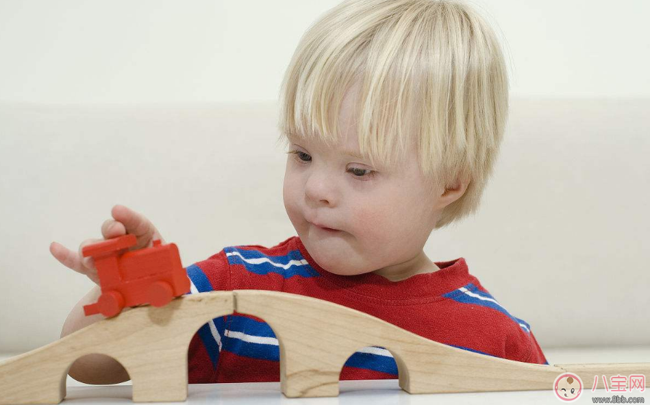 孕期唐氏綜合癥篩查如何看報告單 胎兒有唐氏綜合癥會怎么樣