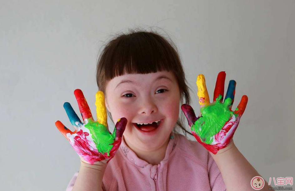 孕期唐氏綜合癥篩查如何看報告單 胎兒有唐氏綜合癥會怎么樣