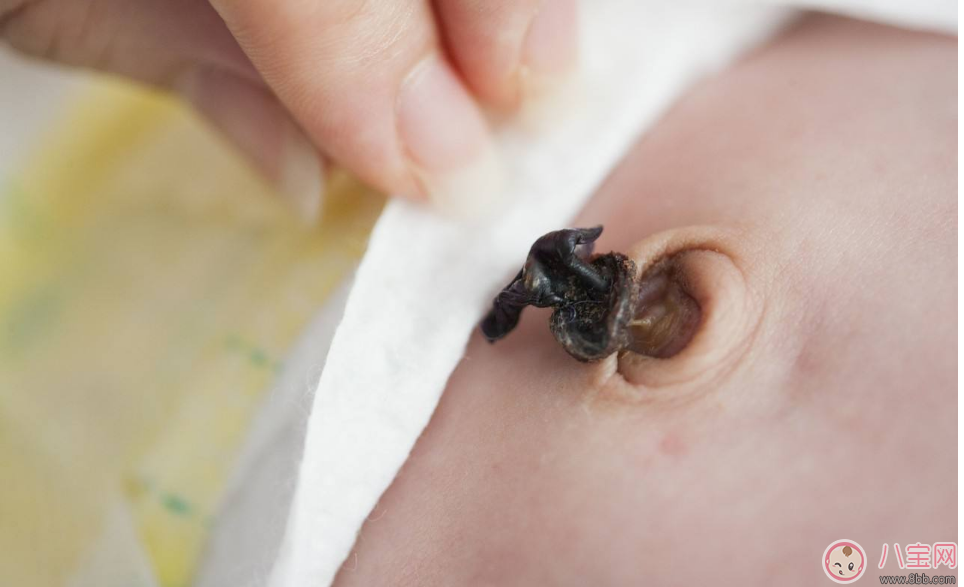 新生兒的臍帶要多久才脫落 寶寶臍帶脫落后如何護理 新生兒的臍帶要多久才脫落 寶寶臍帶脫落后如何護理